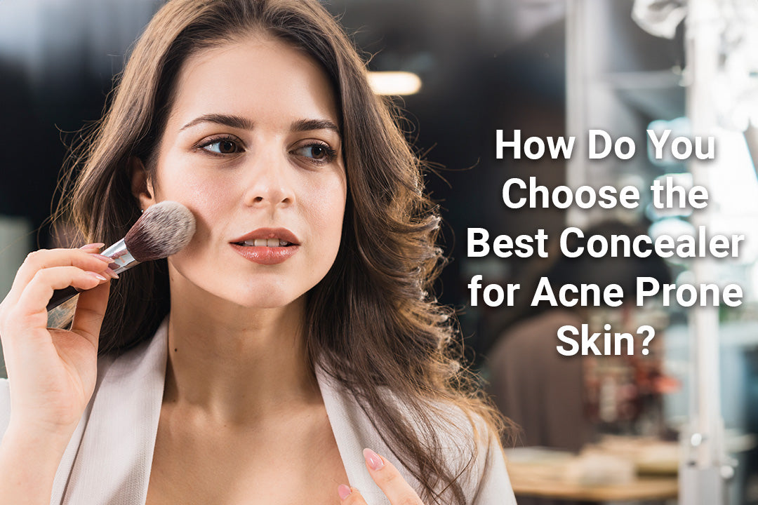 best concealer for acne prone skin